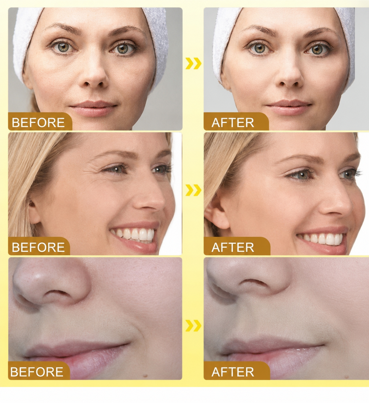 Botox Bee Venom Wrinkle Cream